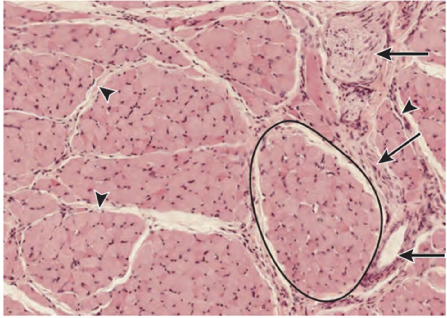 <p>A section of the lip that shows transverse sections of skeletal muscle is examined by a group of first-year medical students (shown in the image). Identify the structure indicated by the oval line.</p><p>(A) Muscle fascicle</p><p>(B) Muscle fiber</p><p>(C) Myofibril</p><p>(D) Myofilament</p><p>(E) Sarcomere</p>