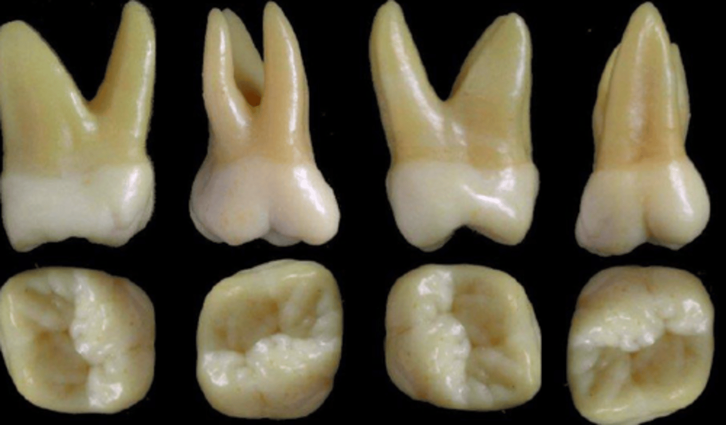 <p>what tooth is this &amp; why?</p>