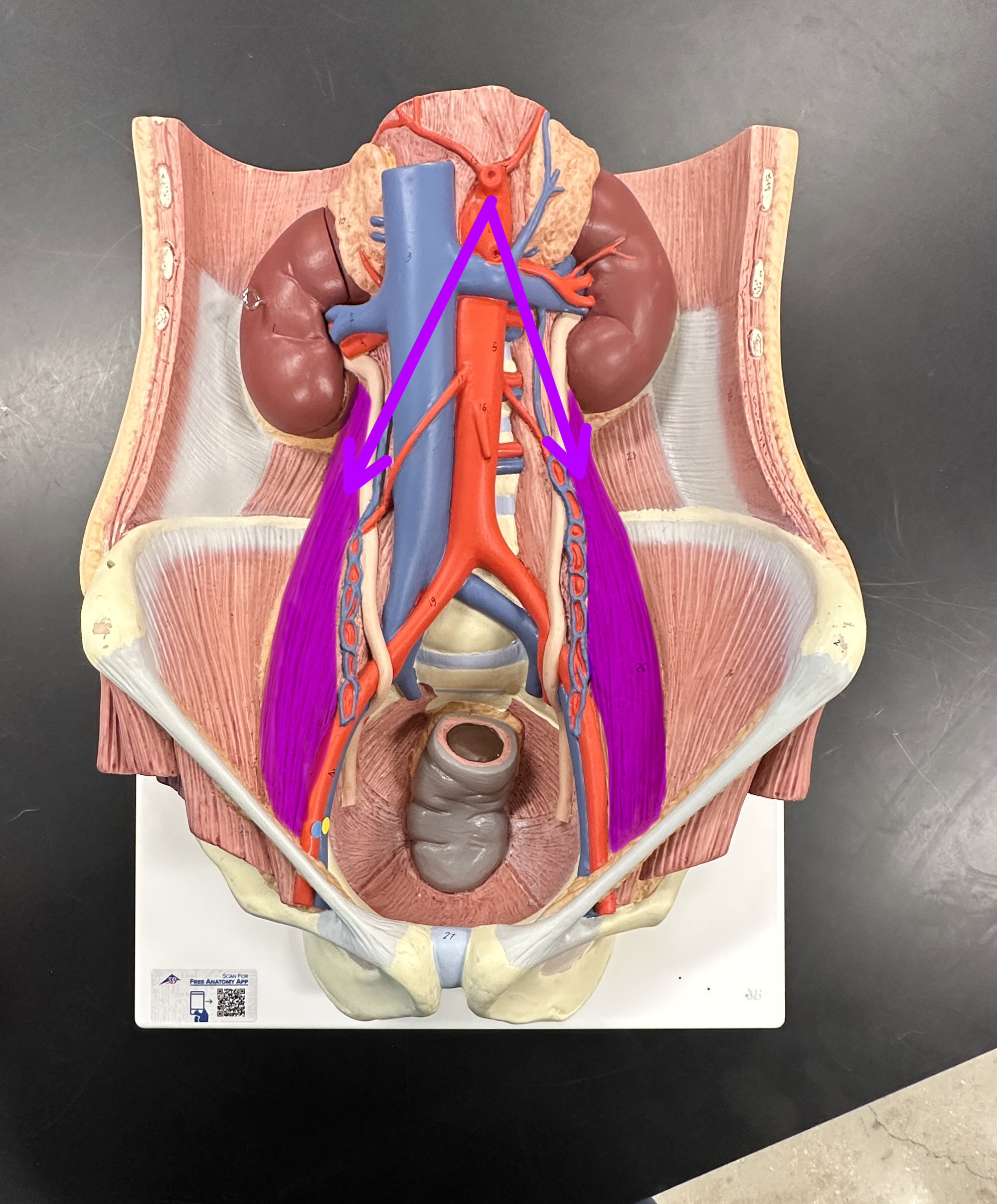 <p>What is the highlighted structure</p>