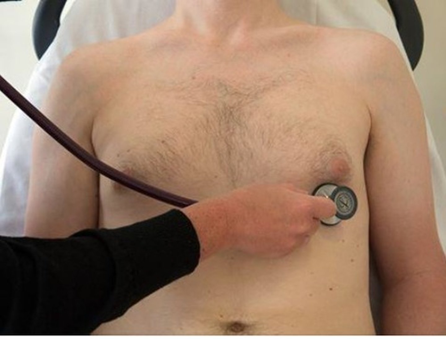 <p>C. Mitral Valve</p>