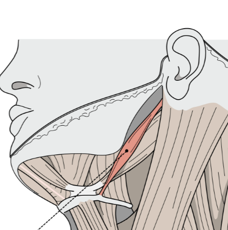 <p>What is this muscle?</p>
