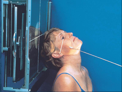 <ul><li><p>patient position:</p><ul><li><p>upright (seated) or supine (torso elevated)</p></li></ul></li><li><p>part position:</p><ul><li><p>hyperextend neck and rest head on vertex</p></li><li><p>IOML as parallel with IR as possible</p></li><li><p>rotate MSP of head 15 degrees toward side being examined</p></li><li><p>tilt top of head 15 degrees away from side being examined </p></li><li><p>center zygomatic arch to IR</p></li></ul></li><li><p>respiration suspended</p></li><li><p>CR:</p><ul><li><p>perpendicular to IOML</p></li><li><p>centered to zygomatic arch 1 inch posterior to outer canthus </p></li></ul></li></ul><p></p>