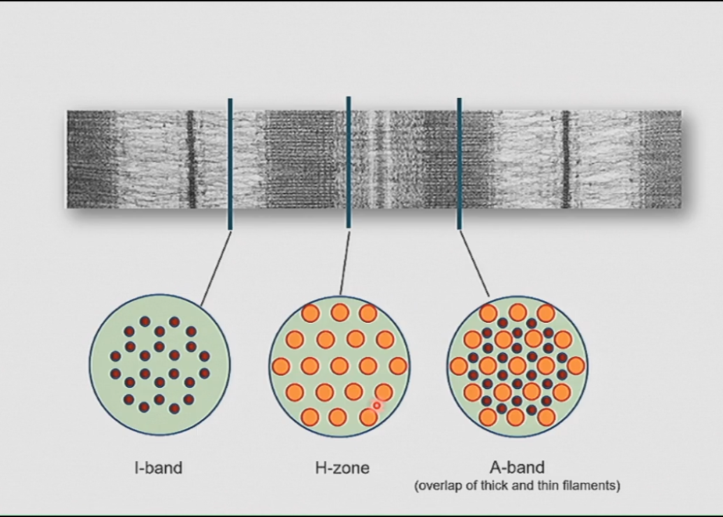 <p>I band = thin filaments (actin)</p><p>A band = thin and thick filaments </p><p>H zone = thick filaments (myosin)</p>