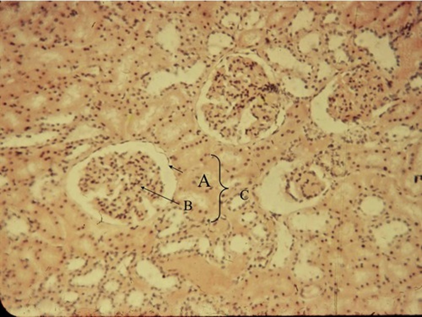 <p>Filtration occurs when fluid and solutes are forced from the blood in the glomerulus into the-</p>