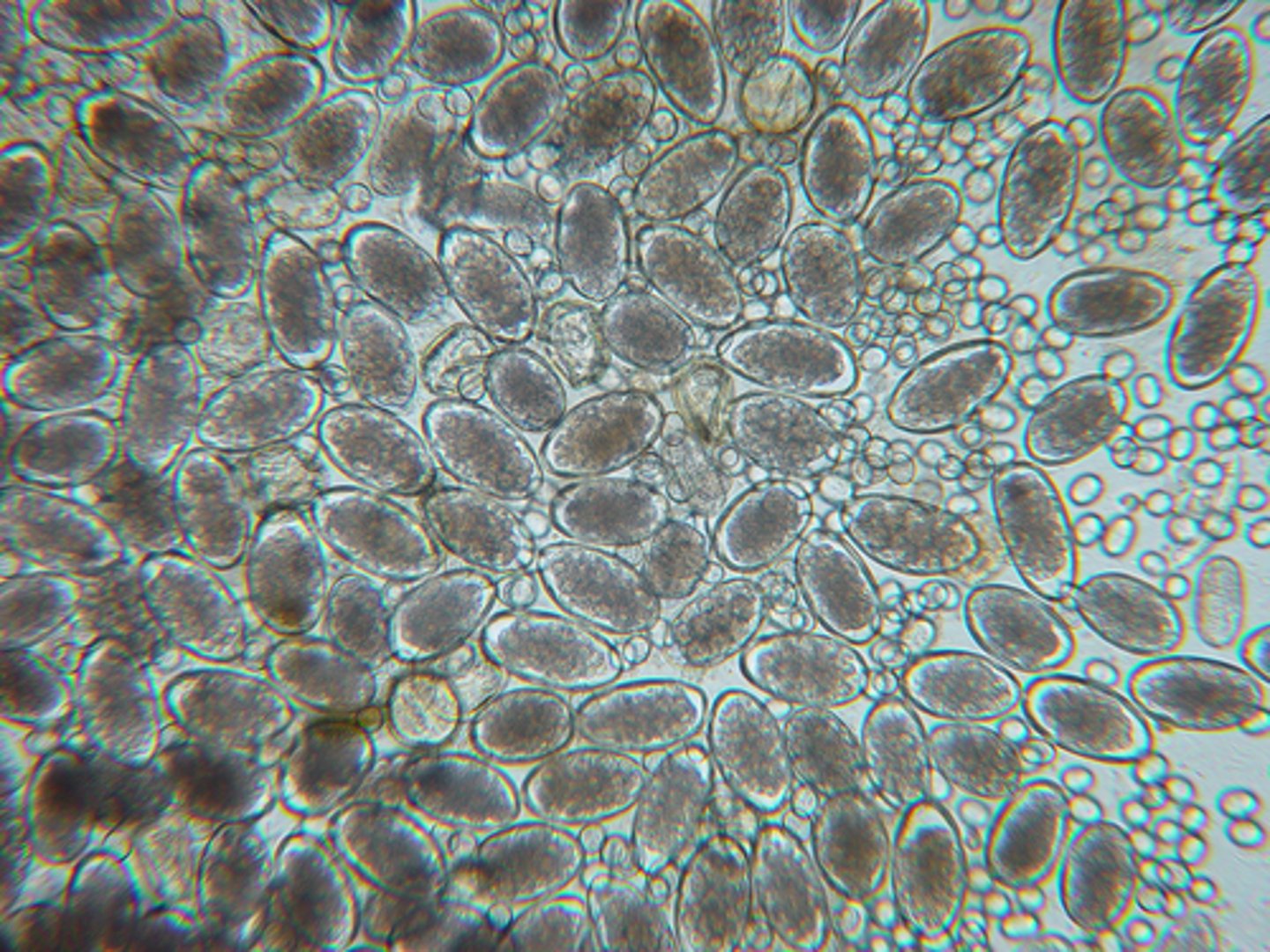<p>These eggs were found on the fecal flotation of an adult Nubian goat with a FAMACHA score of 3. What parasite is most likely the culprit?</p>