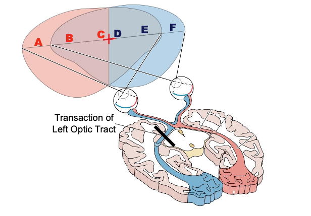 <p>Which letters can you read? </p>