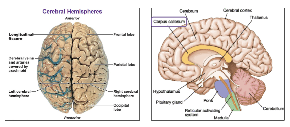 <p><strong>Corpus callosum</strong> (white matter structure).</p>