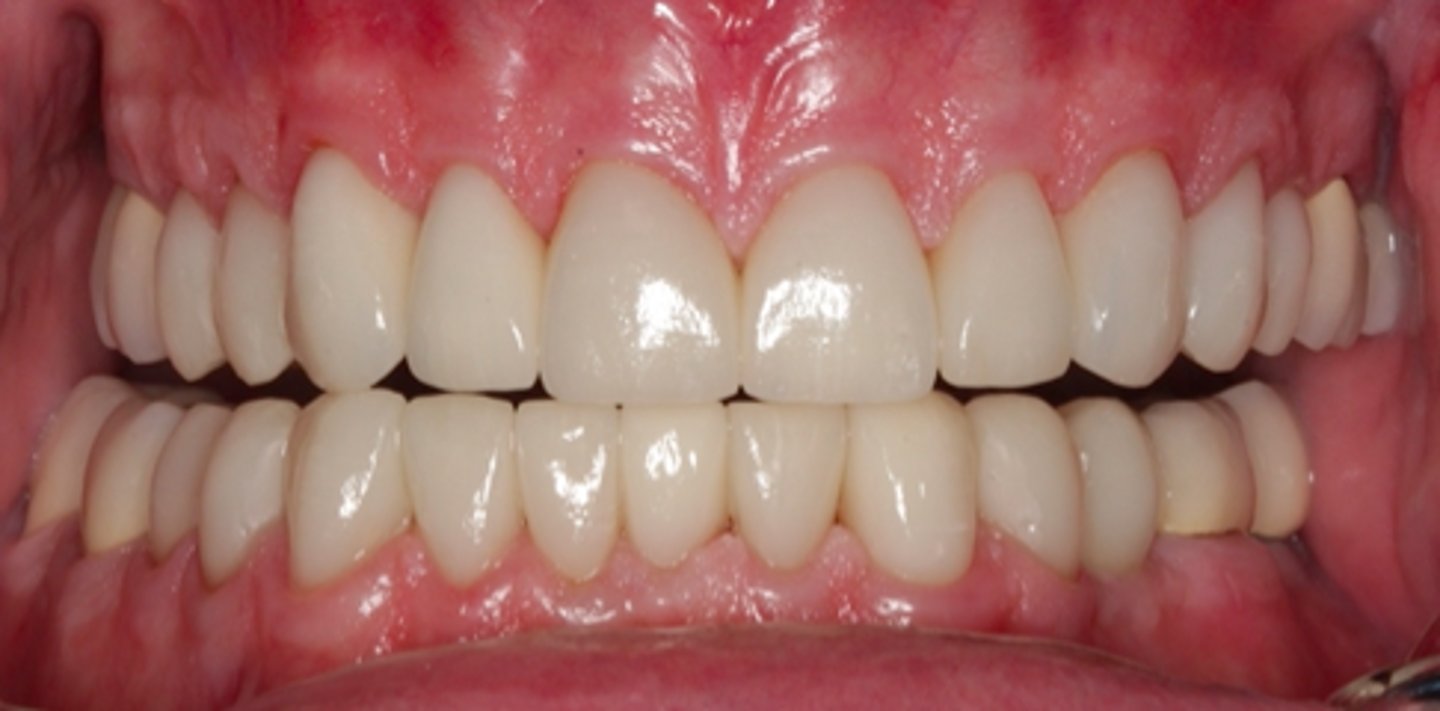 <p>ID the mandibular movement/position</p>