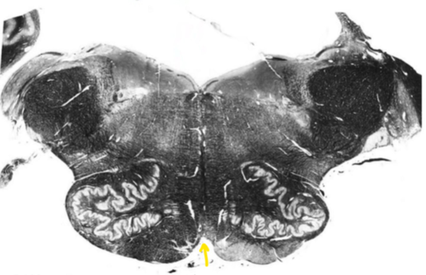 <p>ID the structure</p>