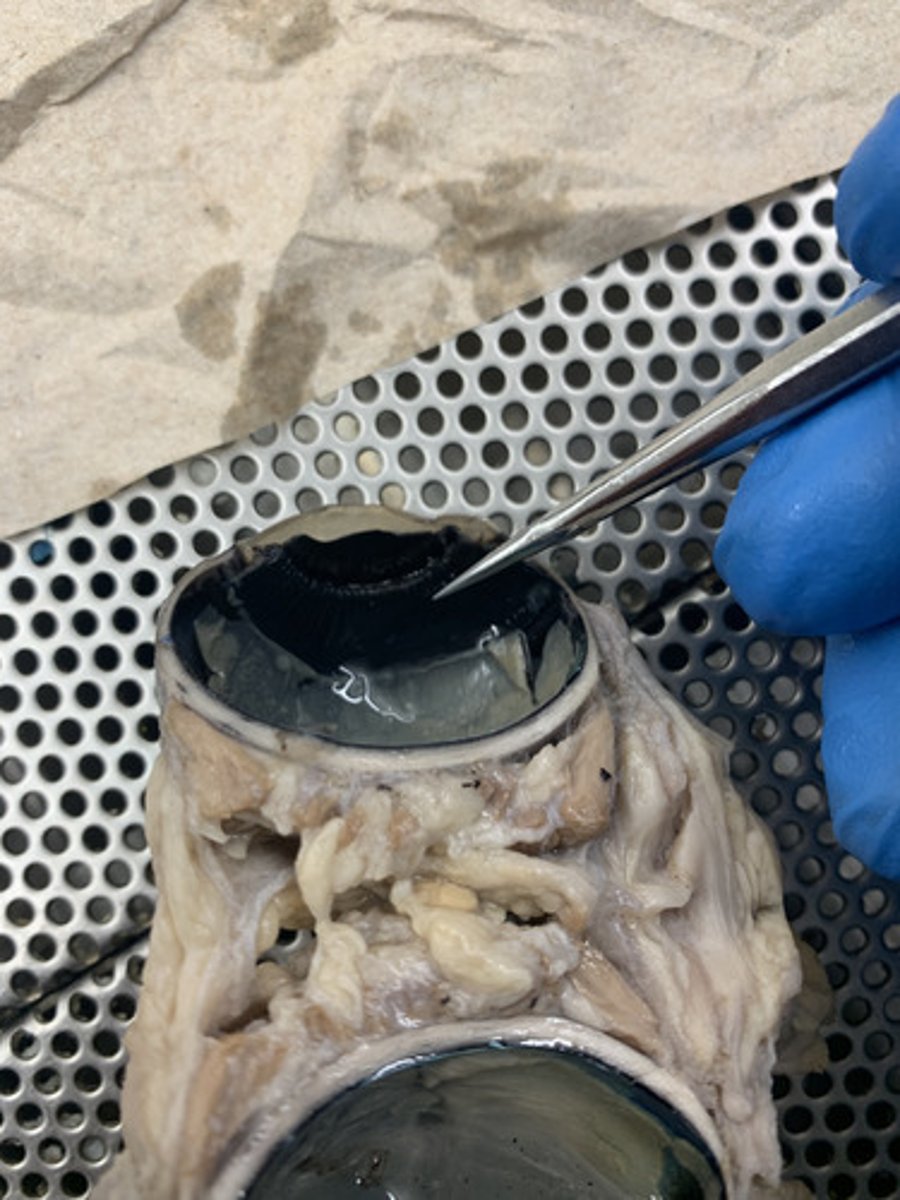 <p>ring of tissue behind the peripheral iris that is composed of ciliary muscle and ciliary processes</p>