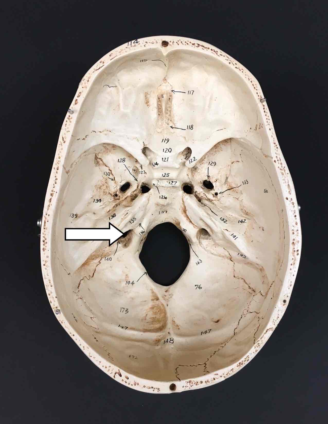 <p>name the cranial nerves the pass through this hole and their roman numerals</p>