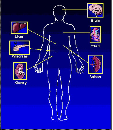 <p><strong>Death</strong> within a few years due to cardiac or renal failure</p>