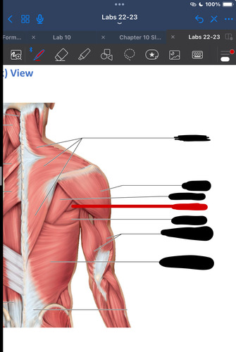 <p>What muscle is this?</p>