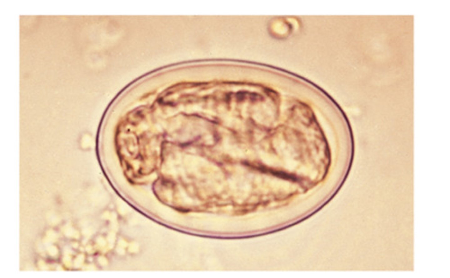 <p>This nematode ovum is smooth, thick-shelled and embryonated (larvated). The adults reside in the stomach, attached to the mucosal surface. What nematode is this?</p>