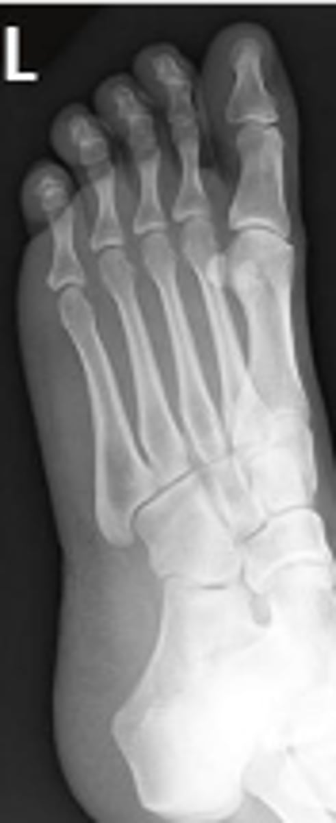 <p>What is the name of the radiographic view?</p>