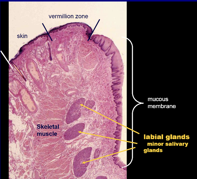 <ul><li><p>Vermillion zone is the external region:</p><ul><li><p><strong>Thin epidermis and high dermal papillae cause it to appear red/pinkish </strong></p></li><li><p>No sweat glands, hair follicles, or sebaceous glands—prone to excessive dryness and chapping </p></li></ul></li><li><p>Internally:</p><ul><li><p>Nonkeratinized with many minor salivary glands</p></li></ul></li></ul>