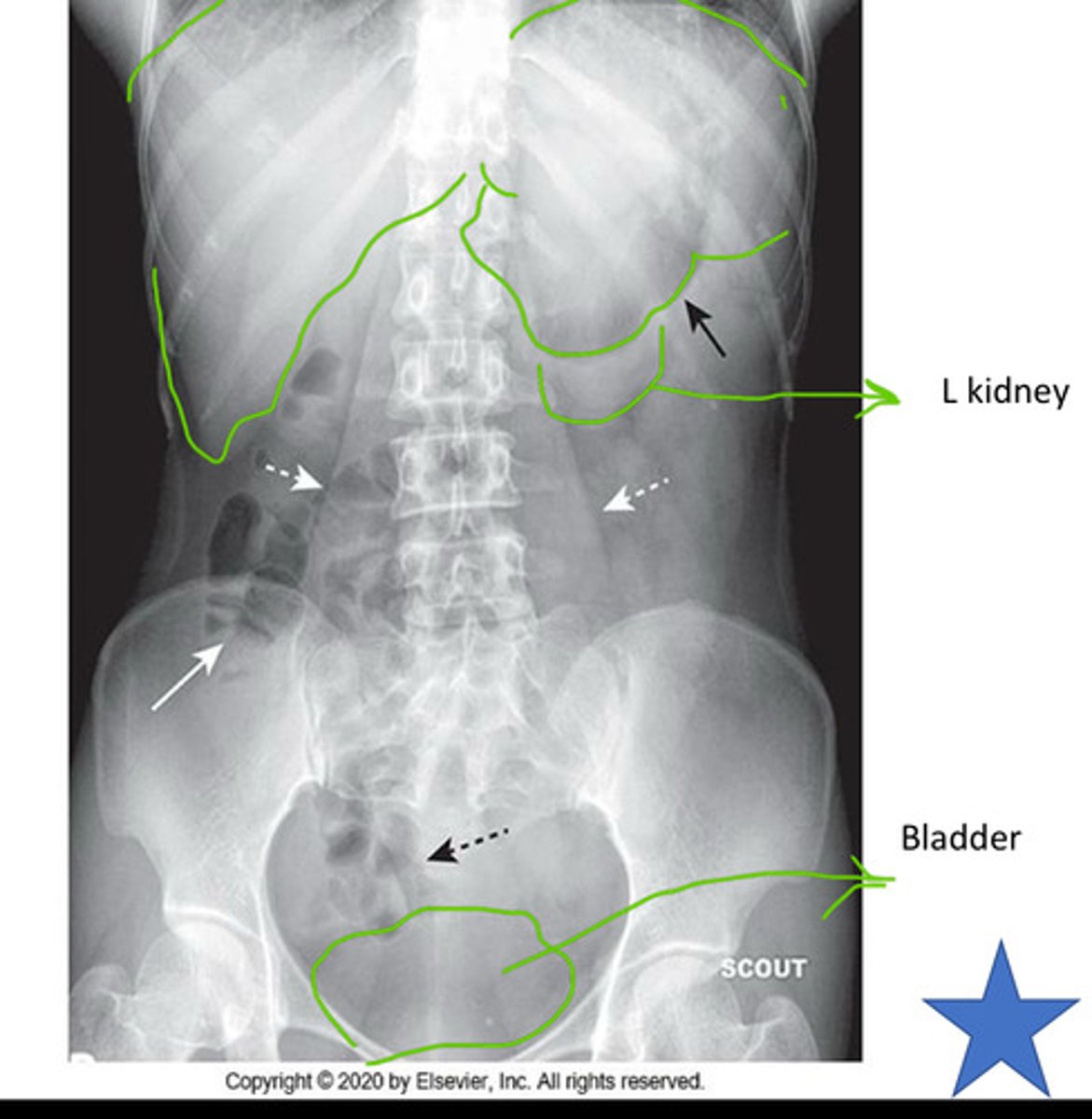 <p>diaphragms, stomach, liver, kidneys shadow, small &amp; large bowel</p>