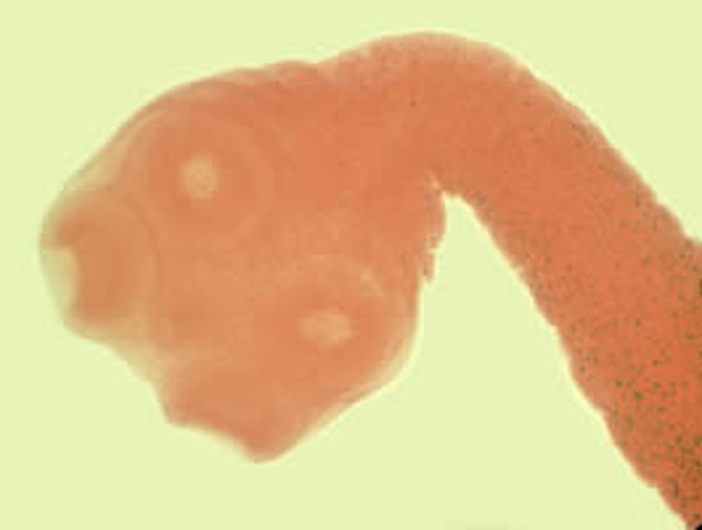 <p>no hooks, 4 suckers</p>