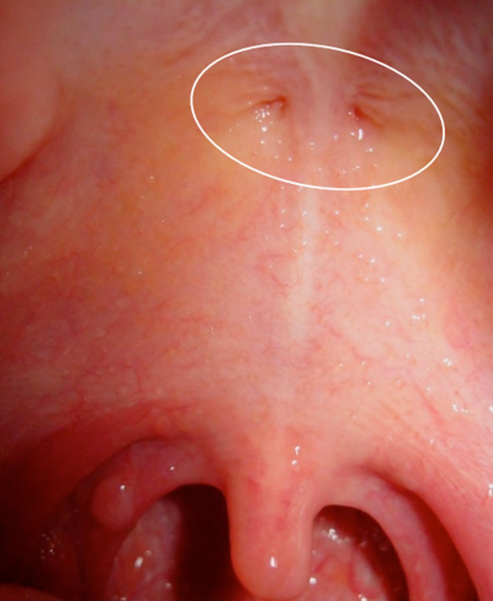 <p>two small pits or depressions in the posterior aspect of the palate, one on each side of the midline, at or near the attachment of the soft palate to the hard palate and slightly anterior to the termination of the denture.</p>