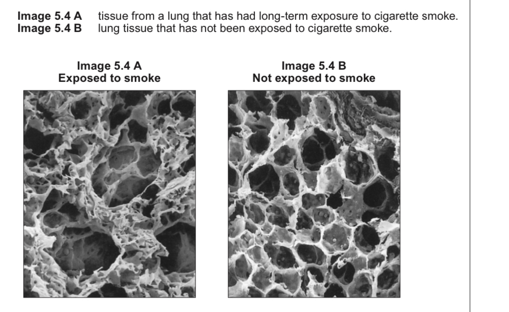 <p>Describe a difference in appearance of the two lung samples and explain how this would decrease GE efficiency </p>