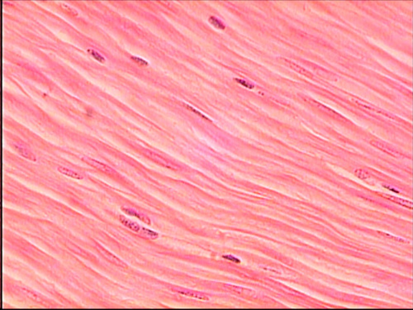 <p>Involuntary muscle with spindle-shaped myocytes found in hollow organs, lacking striations.</p>