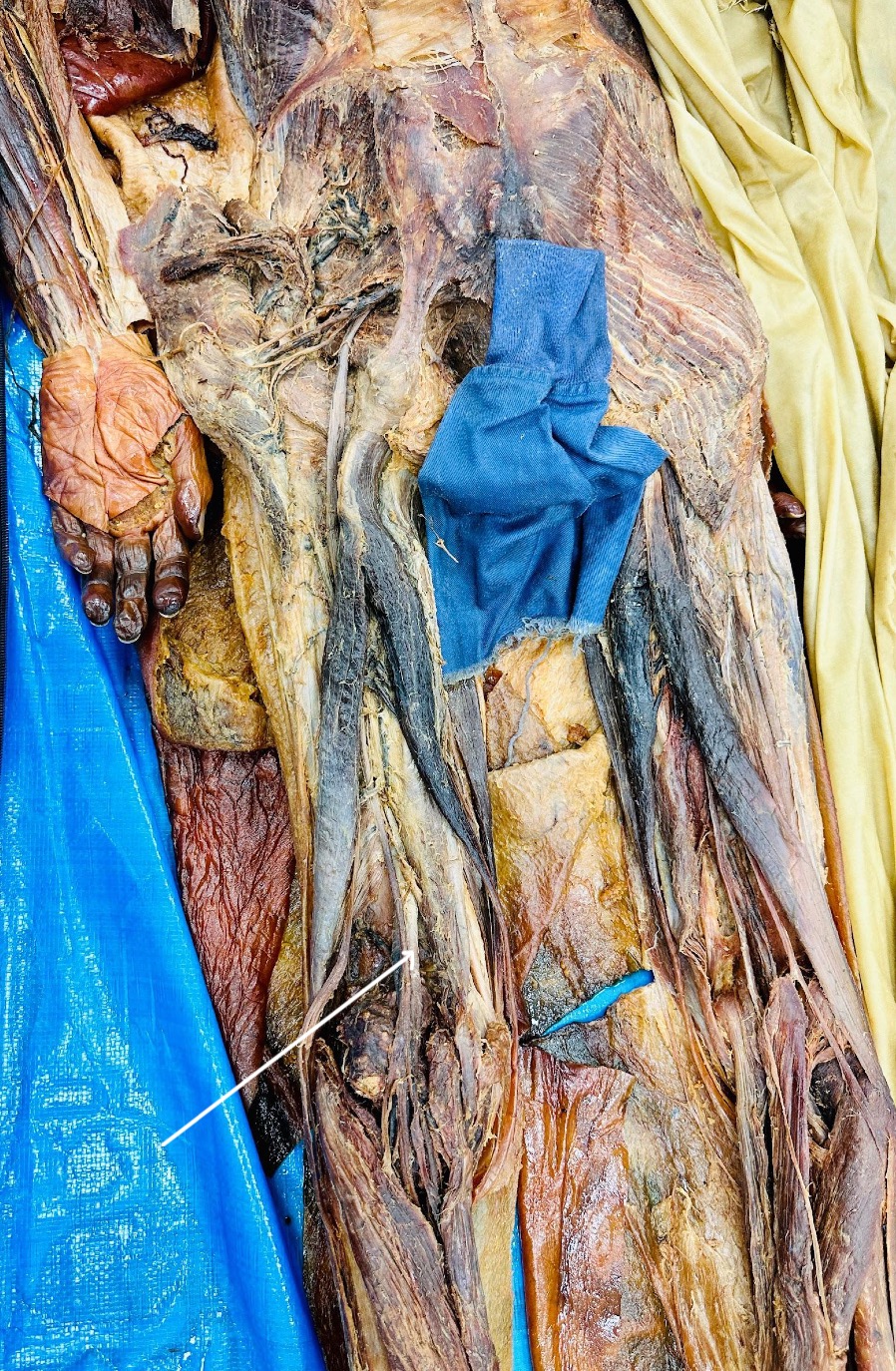 <p>Identify the Structure</p>