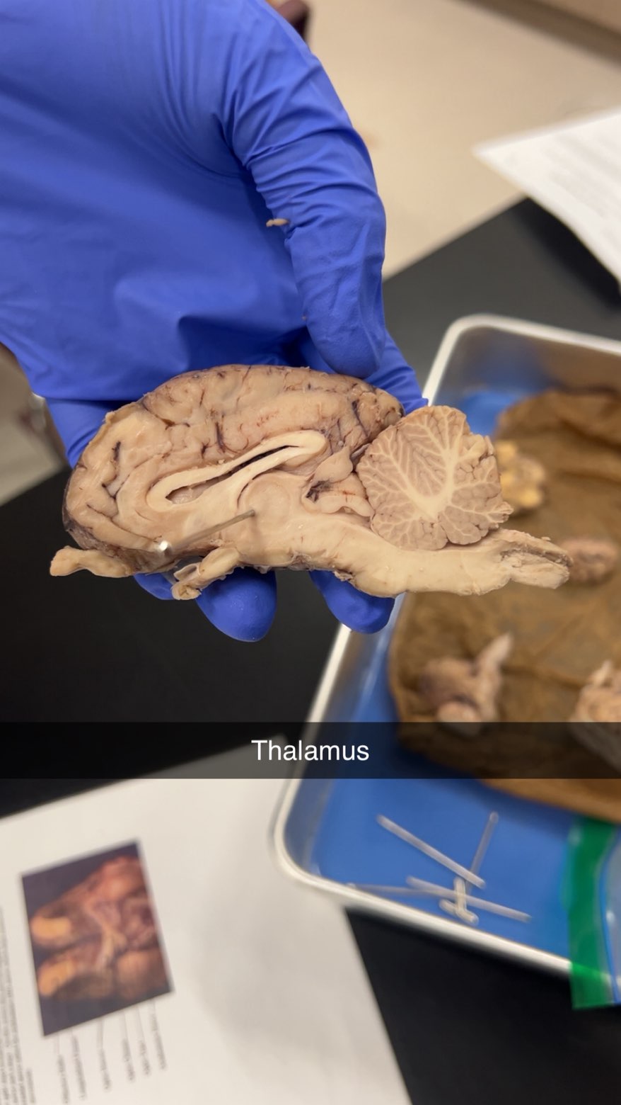 <p>thalamus</p>