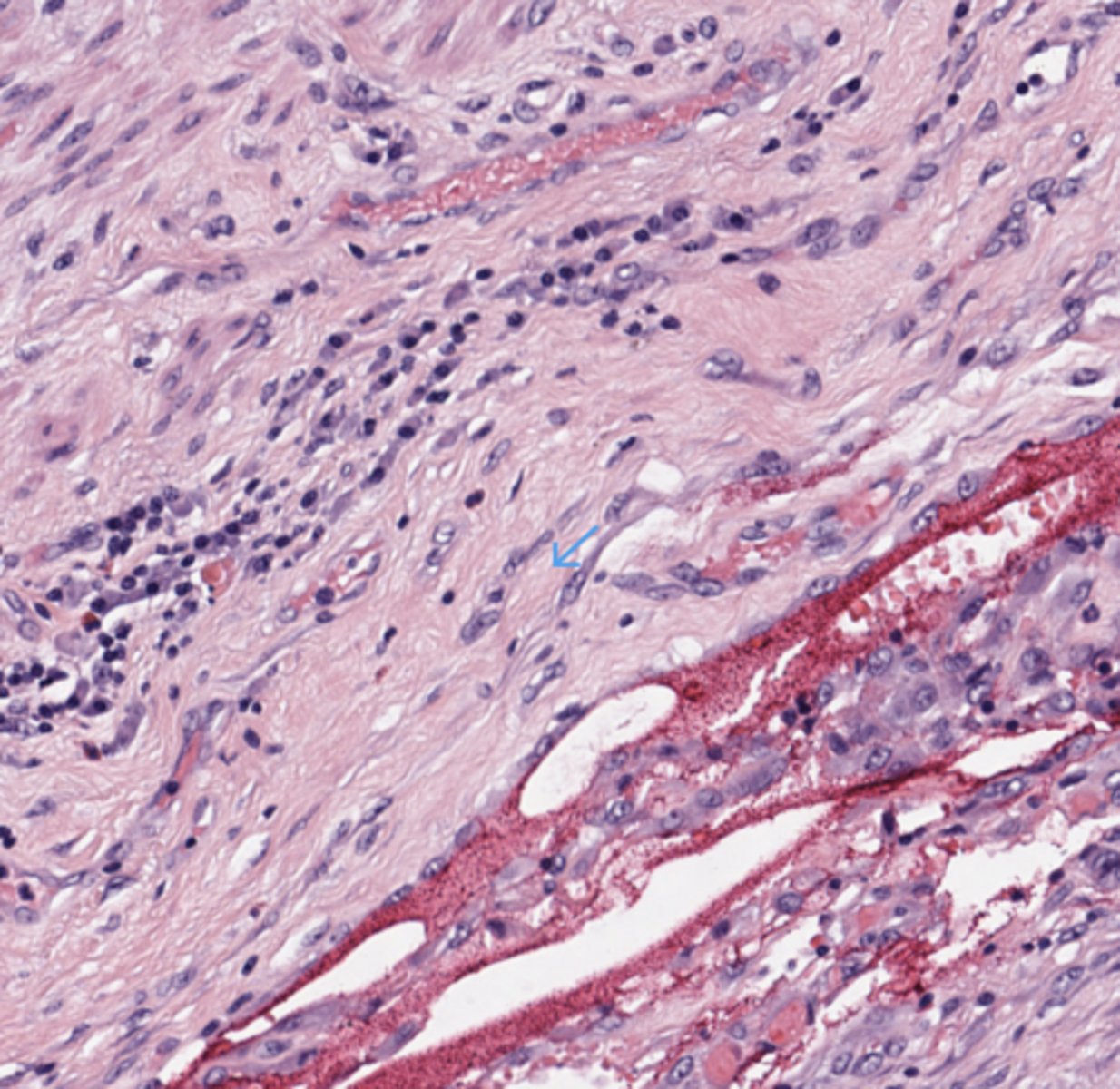 <p>Colon</p>