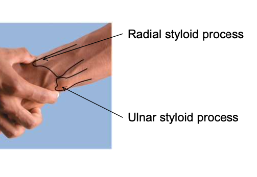 <p>attachment points for the ligaments that anchor the wrist</p>