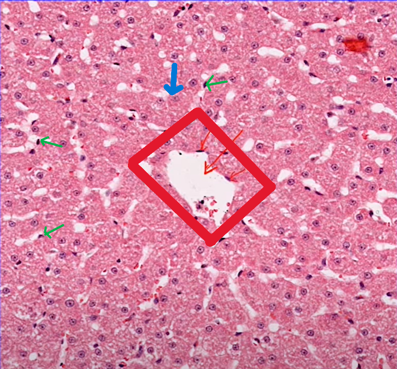 <p>Organ?</p><p>Structure outlined in red?</p><p>Blue cell? (most common cell)</p><p>Green cell? (Typically found in sinus and stained blue/dark)</p>