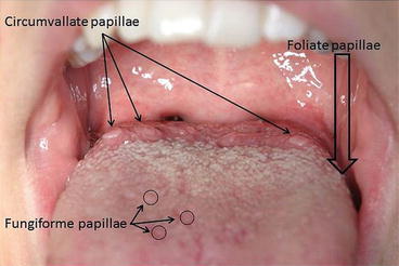 <p>Filiform papillae</p>