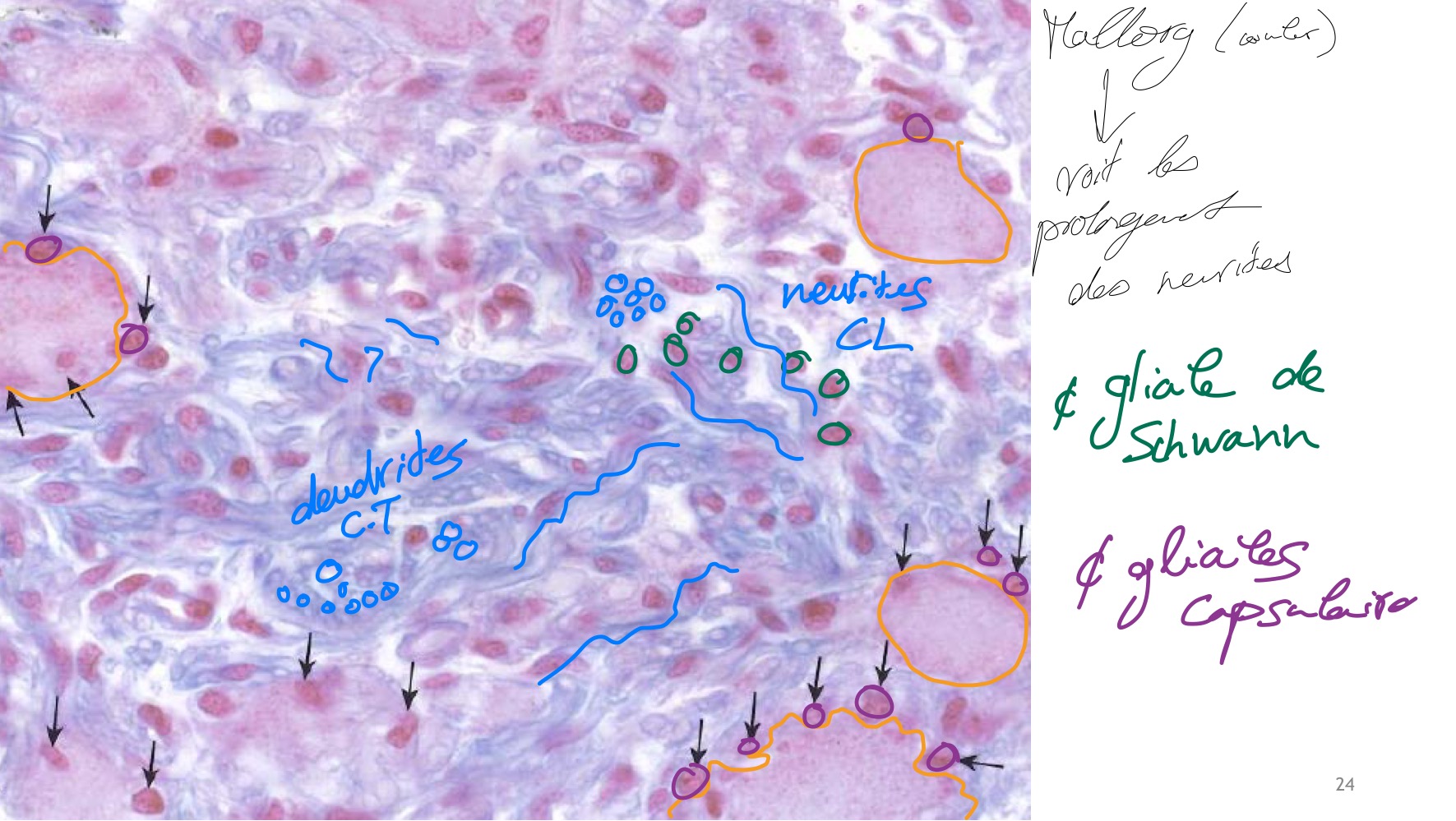 <p>MO, paraffine, mallorg (Voir les prolongement des neurites) </p><p>Cellule ganglionnaires + cellule gilale capsullaire et cellule de Swchann </p>