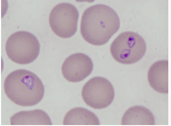 <p>which species of canine babesiosis is this?</p>