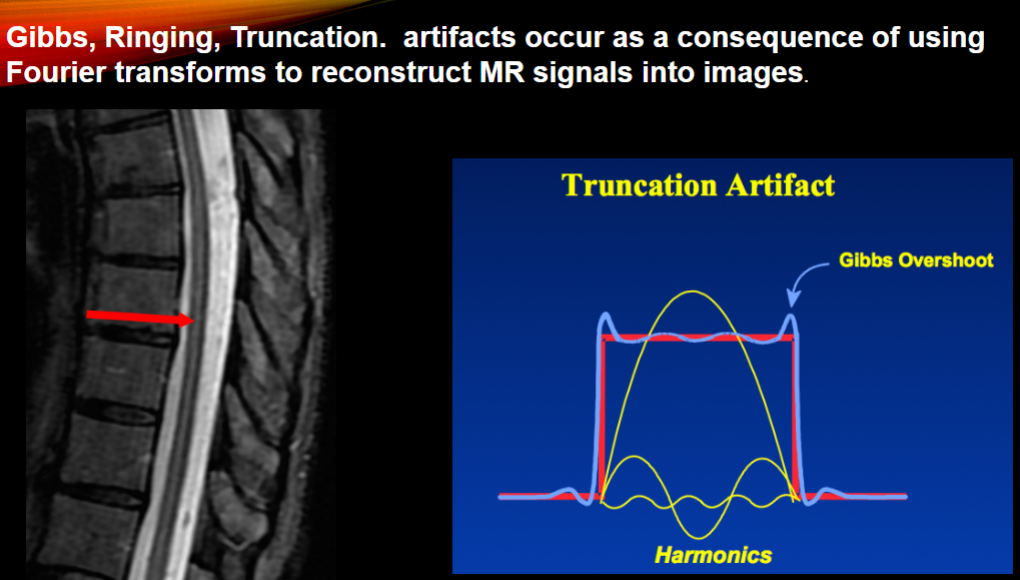 <p><span><strong>Ringing artifacts are more commonly observed when using small pixel sizes and when high contrast boundaries appear in the image</strong></span></p><p><span><strong>when Fourier transformed, frequencies added up, aiming for rectangular slice. Realistically there will be horns called Gibbs overshoot, leading to ringing artefact</strong></span></p>