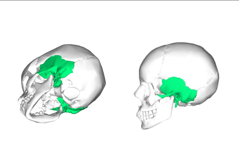 <p>Which cranial bone is this? (2)</p>