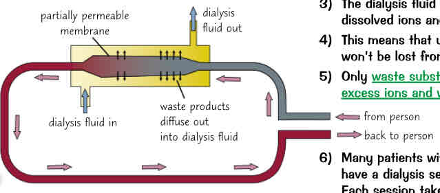 <ol><li><p>dialysis has to be done regularly to keep concentrations of dissolved substances in blood at normal levels, &amp; to remove waste substances</p></li><li><p>in dialysis machine persons blood flows between partially permeable membranes surrounded by dialysis fluid. permeable to things like ions &amp; waste substances but not big molecules (like in kidneys)</p></li><li><p>dialysis fluid has same concentration of dissolved ions &amp; glucose as healthy blood</p></li><li><p>means useful dissolved ions &amp; glucose won’t be lost from blood during dialysis</p></li><li><p>only waste substances (urea) &amp; excess ions &amp; water diffuse across barrier</p></li><li><p>many patients w kidney failure have to have dialysis sessions 3x week, each session takes 3-4 hours</p></li><li><p>dialysis may cause blood clots/ infections </p></li><li><p>being on dialysis machine is not pleasant experience &amp; its expensive for NHS to run</p></li><li><p>dialysis can buy a patient w kidney failure valuable time until donor organ is found</p></li></ol>