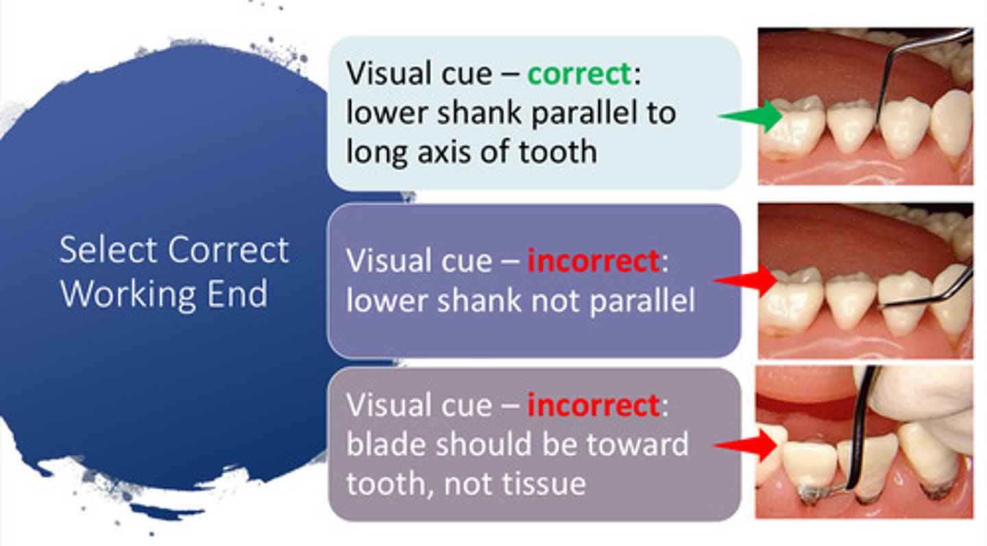 <p>visual cue: the lower shank should be parallel to the long axis of the tooth &amp; the blade should be toward the tooth, not the tissue</p>
