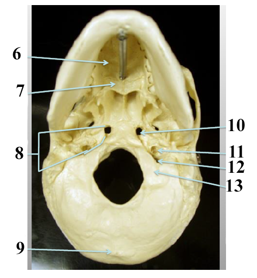 <p>What structure is number 9?</p>