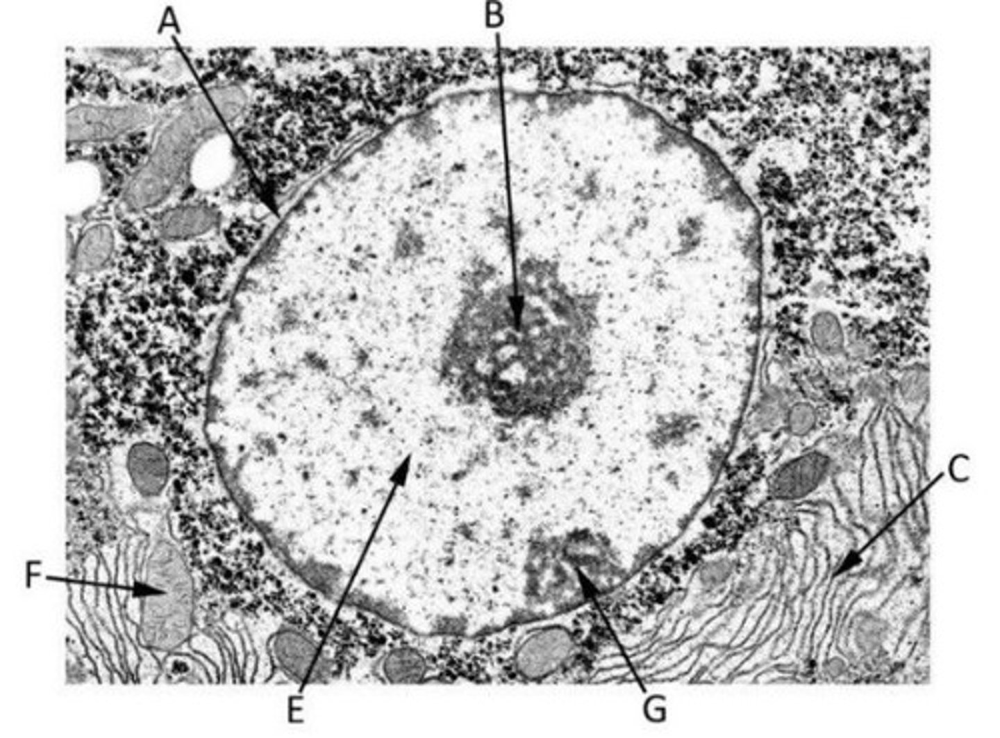 <p>Identify the featurees in this TEM image of a nucleus</p>