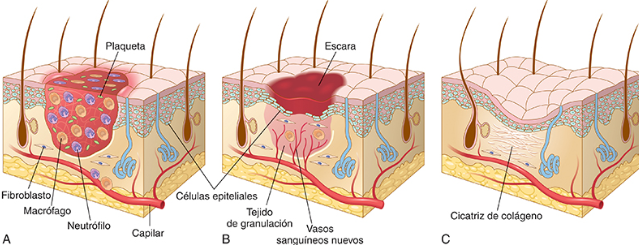 <p>inflamación,  proliferación celular, formación de tejido de granulación y deposito de tejido conjuntivo</p>