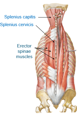 <p>iliocostalis, longissimus, spinalis (ILS – I love spanking – lateral to medial)</p>
