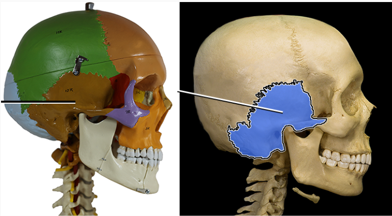 <p>The inferior sides of the cranial vault are formed by the left and right ___ ____. join the parietal bones via a squamosal suture.</p>