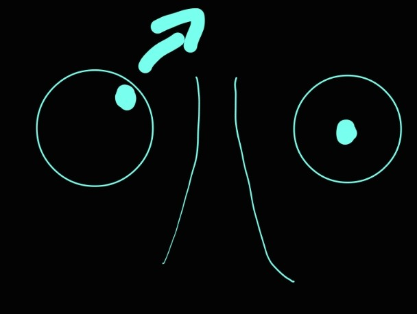 <p>superior rectus muscle</p>