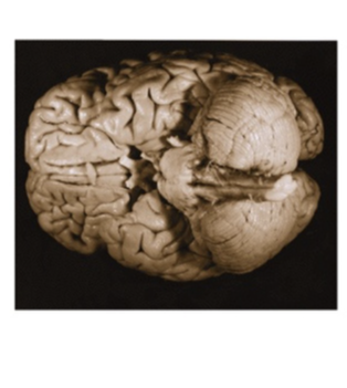 <p>What view of the brain is this</p>