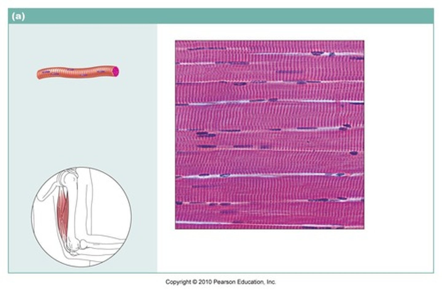 <p>name the type of muscle tissue</p>