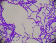 <p>Streptobacilli</p>