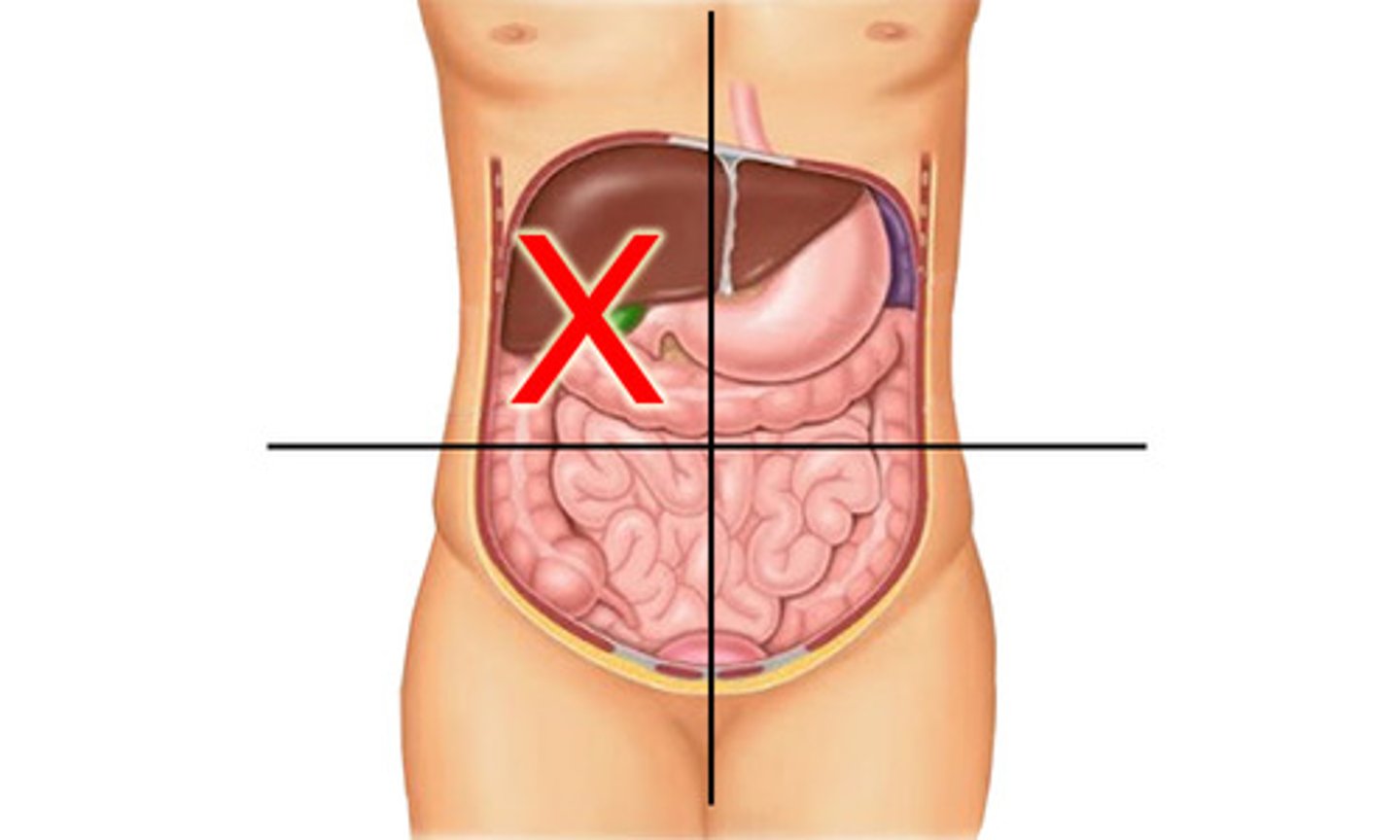 <p>4 quadrants: top right</p>