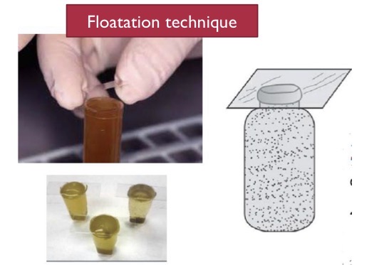 <p>A- what is the method of examination used here </p><p>B-identify the technique</p><p>C- Used for what</p><p>D- <strong>Why can't concentration methods be used to detect Trophozoites?</strong></p><p><strong>E- Give another example of the same technique</strong></p>