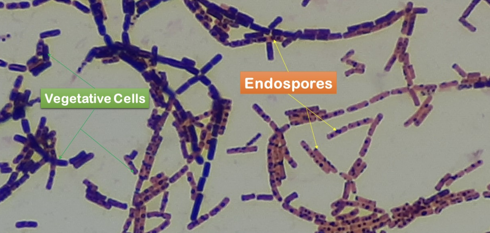 <p><span style="font-family: "Times New Roman", serif;">Which organism is shown in this image?</span></p>