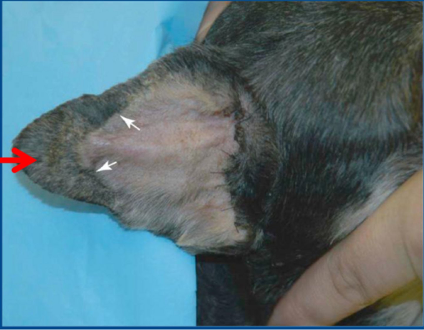 <p>complications associated with TECA-LBO</p>